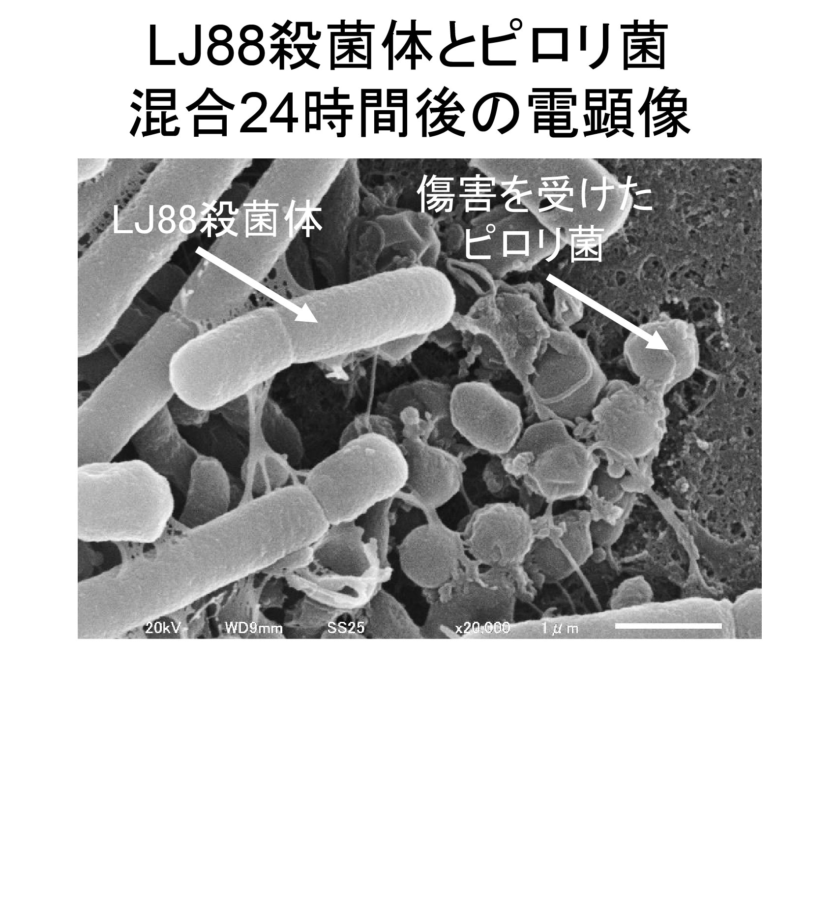 LJ88殺菌体とピロリ菌混合24時間後の電顕像