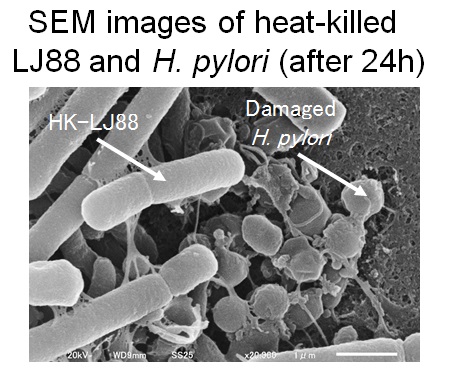 LJ88殺菌体とピロリ菌混合24時間後の電顕像